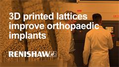 3D printed lattices improve orthopaedic implants